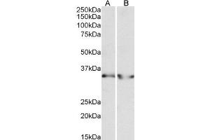 ABIN4902694 (0. (LDHB antibody)