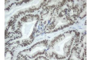Image no. 2 for anti-Splicing Factor 3a, Subunit 1 (SF3A1) (AA 249-568) antibody (ABIN1491272) (SF3A1 antibody  (AA 249-568))