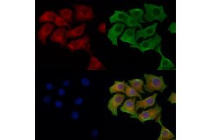 ABIN6259606 and ABIN6274170 staining HepG2 cells by IF/ICC.