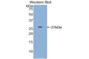 Western Blotting (WB) image for anti-Myocilin (MYOC) (AA 224-471) antibody (ABIN1859952) (MYOC antibody  (AA 224-471))