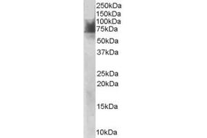 ABIN185394 staining (1µg/ml) of Human Duodenum lysate (RIPA buffer, 30µg total protein per lane). (SLC6A4 antibody  (Internal Region))