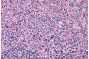 Human Tonsil: Formalin-Fixed, Paraffin-Embedded (FFPE) (ELP3/KAT9 antibody  (AA 240-445))