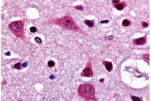 Anti-LGR4 antibody  ABIN1049005 IHC staining of human brain, caudate. (LGR4 antibody  (N-Term))