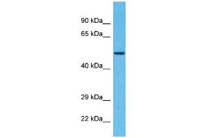 Host:  Rabbit  Target Name:  ZSCAN22  Sample Type:  Breast Tumor lysates  Antibody Dilution:  1. (ZSCAN22 antibody  (N-Term))