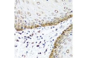 Immunohistochemistry of paraffin-embedded human esophagus using BMP5 antibody. (BMP5 antibody  (AA 317-454))