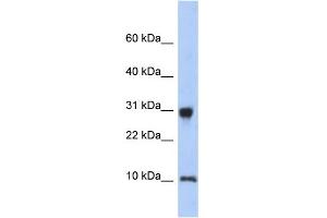 WB Suggested Anti-RPS21 Antibody Titration: 0. (RPS21 antibody  (N-Term))