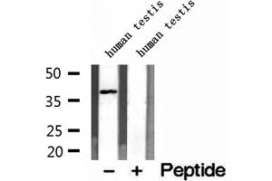 DNAJB14 antibody  (C-Term)