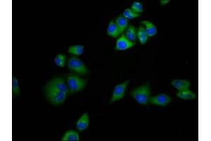 MRAP antibody  (AA 59-172)