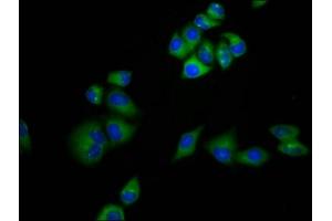 Immunofluorescence staining of Hela cells with ABIN7159221 at 1:133, counter-stained with DAPI. (MRAP antibody  (AA 59-172))
