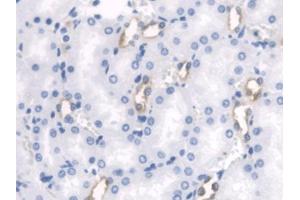 DAB staining on IHC-P; Samples: Rat Kidney Tissue (PTH2R antibody  (AA 27-143))