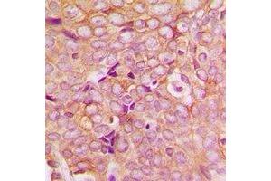 Immunohistochemistry (IHC) image for anti-PDZ and LIM Domain 5 (PDLIM5) antibody (ABIN7308152) (PDLIM5 antibody)
