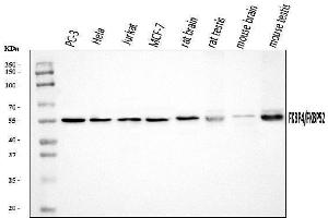 Western blot analysis of FKBP52/FKBP4 using anti-FKBP52/FKBP4 antibody (ABIN7602883).