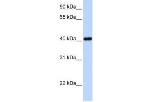 Western Blot showing IRX6 antibody used at a concentration of 1-2 ug/ml to detect its target protein. (IRX6 antibody  (N-Term))