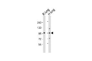 All lanes : Anti-Med15 Antibody (C-term) at 1:2000 dilution Lane 1: rat lung lysates Lane 2: human lung lysates Lysates/proteins at 20 μg per lane. (MED15 antibody  (C-Term))