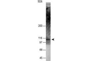 Western blot analysis of NOD2 in 50 ug of HT-29 cell lysate with NOD2 monoclonal antibody, clone 2D9 . (NOD2 antibody  (AA 28-301))