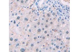 Used in DAB staining on fromalin fixed paraffin- embedded Kidney tissue (NSMAF antibody  (AA 176-575))