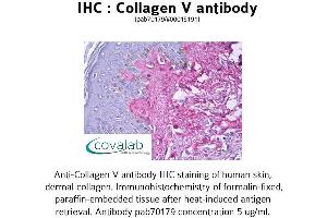 Image no. 1 for anti-Collagen, Type V (COL5) antibody (ABIN1733224) (Collagen Type V antibody)