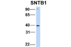 SNTB1 antibody  (N-Term)