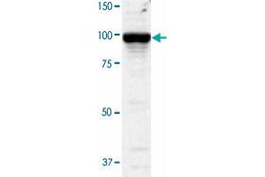 Western blot analysis of COS-1 cells transfected withPDE5A by using PDE5A polyclonal antibody  at 1:2000 dilution. (PDE5A antibody)