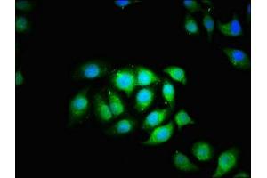 Immunofluorescence staining of A549 cells with ABIN7171419 at 1:166, counter-stained with DAPI. (CCT5 antibody  (AA 1-270))