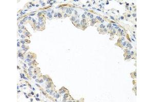 Immunohistochemistry of paraffin-embedded Mouse lung using IL22 Polyclonal Antibody at dilution of 1:100 (40x lens). (IL-22 antibody)