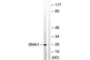 Western blot analysis of extracts from HT29 cells, using SNAI1 (Ab-246) Antibody. (SNAIL antibody  (AA 215-264))
