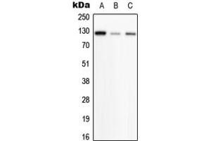 Western blot analysis of PHKB expression in HeLa (A), SP2/0 (B), H9C2 (C) whole cell lysates. (PHKB antibody  (Center))