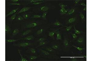 Immunofluorescence (IF) image for anti-Golgin A5 (GOLGA5) (AA 1-731) antibody (ABIN523333)
