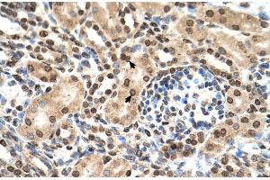 Human kidney (IFIT3 antibody  (N-Term))