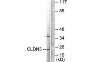 Western blot analysis of extracts from HuvEc cells, using Claudin 3 Antibody. (Claudin 3 antibody  (AA 171-220))