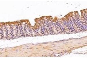 Immunohistochemistry analysis of paraffin-embedded mouse colon using,KIF5B (ABIN7074440) at dilution of 1: 1000 (KIF5B antibody)