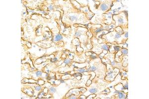 Immunohistochemistry (Paraffin-embedded Sections) (IHC (p)) image for anti-Annexin A4 (ANXA4) antibody (ABIN7073066)