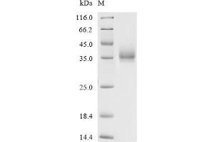 Kallikrein 5 (KLK5) (AA 71-297) protein (His tag)