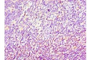 Immunohistochemistry of paraffin-embedded human tonsil tissue using ABIN7143696 at dilution of 1:100 (AKR1C4 antibody  (AA 1-323))