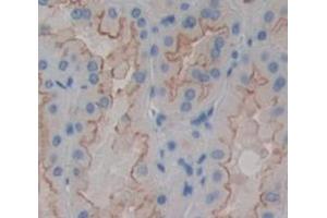 Figure. (MCAM antibody  (AA 324-565))