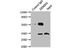 Immunoprecipitating GEMIN2 in 293T whole cell lysate Lane 1: Rabbit control IgG instead of ABIN7153753 in 293T whole cell lysate. (SIP1 antibody  (AA 1-280))