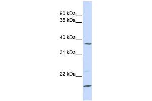 WB Suggested Anti-ZDHHC19 Antibody Titration:  0. (ZDHHC19 antibody  (N-Term))