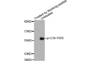 Western blot analysis of extracts from JK cells using Phospho-LCK-Y505 antibody and the same antibody preincubated with blocking peptide. (LCK antibody  (pTyr505))