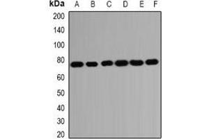 Western blot analysis of HSPA2 expression in SKOV3 (A), Hela (B), A431 (C), mouse brain (D), mouse testis (E), rat kidney (F) whole cell lysates. (HSPA2 antibody)