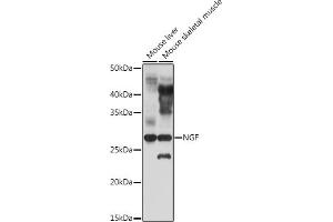 Western blot analysis of extracts of various cell lines, using NGF antibody (ABIN3020811, ABIN3020812, ABIN3020813 and ABIN6213735) at 1:1000 dilution. (Nerve Growth Factor antibody  (AA 19-241))