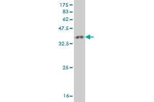 HIC1 antibody  (AA 396-453)