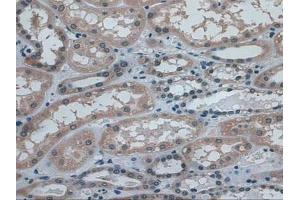 IHC-P analysis of Human Kidney Tissue, with DAB staining. (IDE antibody  (AA 753-973))