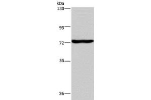 Western Blot analysis of Mouse brain tissue using KCND1 Polyclonal Antibody at dilution of 1:400 (KCND1 antibody)