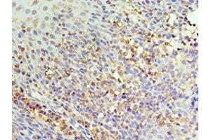 Immunohistochemistry of paraffin-embedded human tonsil tissue using ABIN7156854 at dilution of 1:100 (IL22 Receptor alpha 1 antibody  (AA 16-230))
