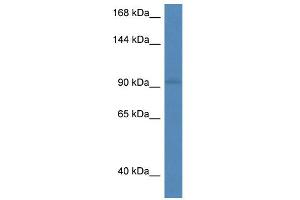 WB Suggested Anti-Reck Antibody Titration: 1. (RECK antibody  (Middle Region))