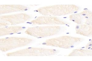 Detection of IL31 in Mouse Skeletal muscle Tissue using Polyclonal Antibody to Interleukin 31 (IL31) (IL-31 antibody  (AA 28-154))