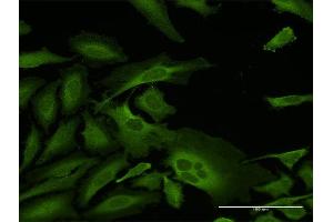 Immunofluorescence of purified MaxPab antibody to CAP1 on HeLa cell. (CAP1 antibody  (AA 1-475))