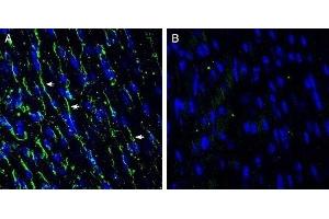 Expression of TMEM66 in mouse heart - Immunohistochemical staining of frozen mouse heart sections with Anti-TMEM66 Antibody (ABIN7043863, ABIN7044034 and ABIN7044035), (1:200), followed by goat anti-rabbit-AlexaFluor-488. (TMEM66 antibody  (Intracellular, Lumenal Region))