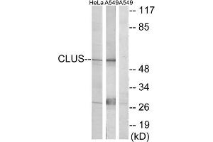 Western blot analysis of extracts from HeLa cells and A549 cells, using CLUS antibody. (Clusterin antibody  (C-Term))