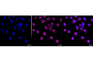 Immunocytochemical staining of HepG2 cells with Chromodomain helicase DNA binding protein 3 antibody (ABIN7798068), 1:1,000). (Recombinant CHD3 antibody)